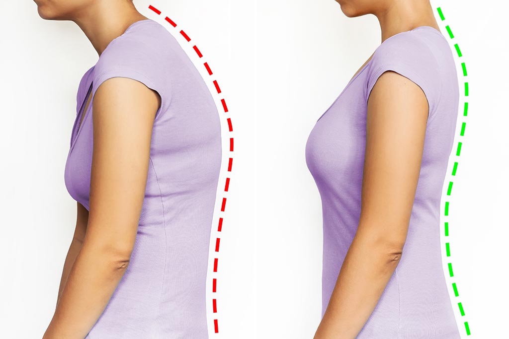 Imagen ilustrativa de una postura correcta versus una incorrecta.